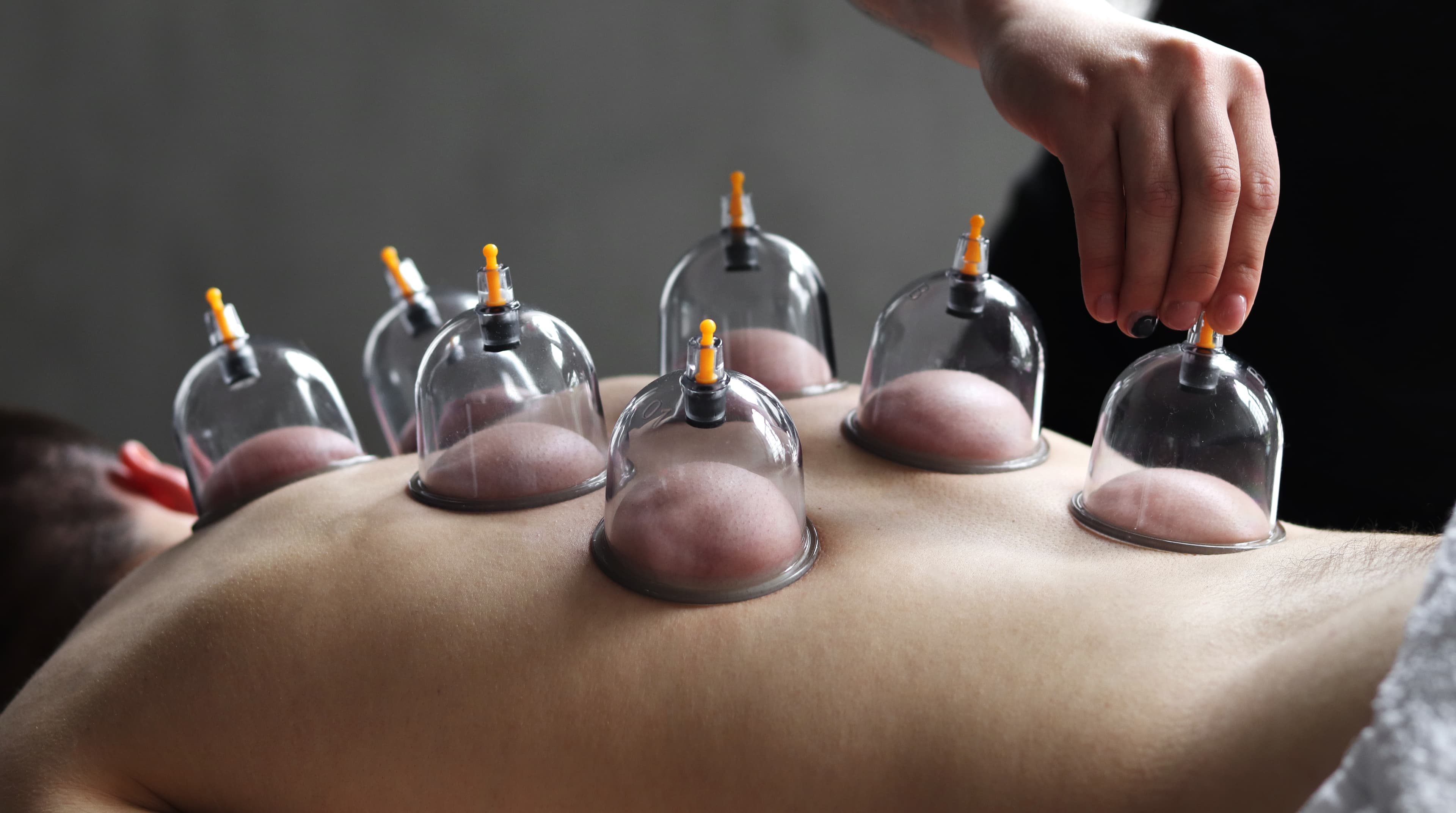 Professional cupping therapy - Mobility & Massage